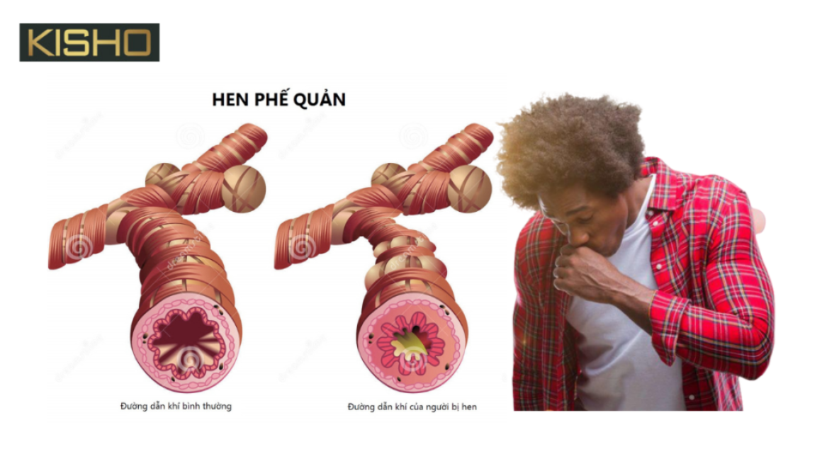 cach-chua-hen-phe-quan-cho-nguoi-lon