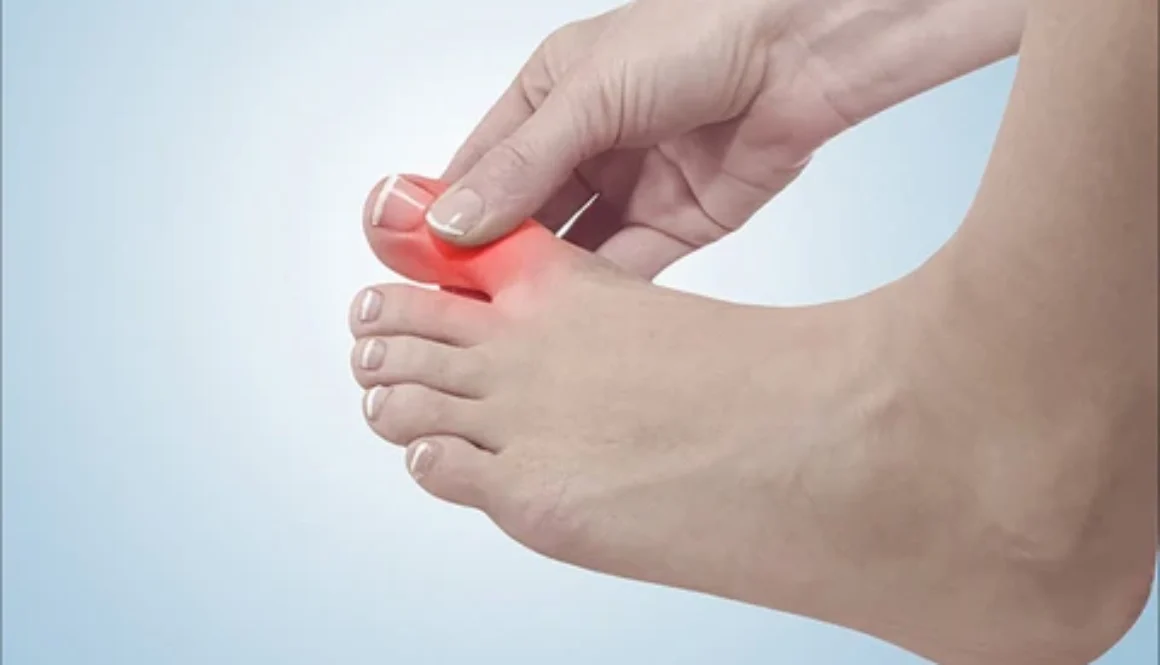benh-gout-1-1710230726607477970783-24-0-624-960-crop-17102310237401582078309