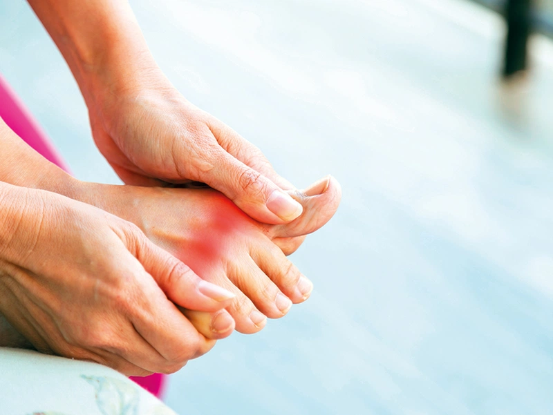 Nguyên tắc điều trị gout trên người suy thận