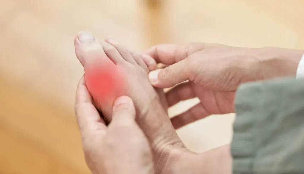 benh-gout-1