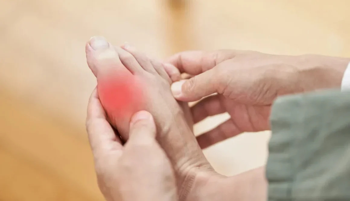 benh-gout-1