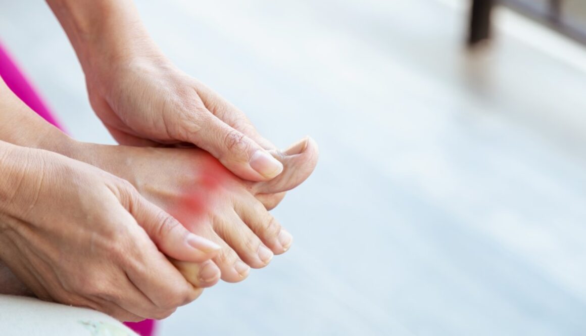 benh-gout-2