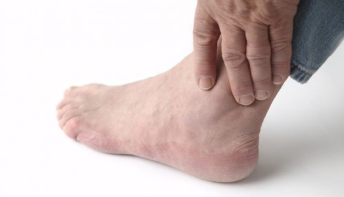 dau-hieu-cua-benh-gout