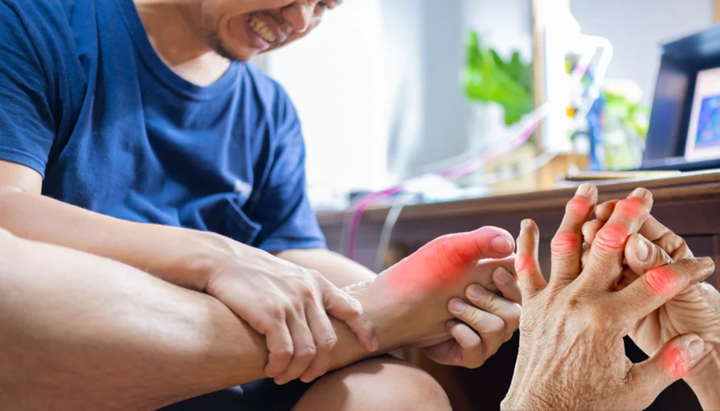 gout_cap_tinh_5_8beda04a99