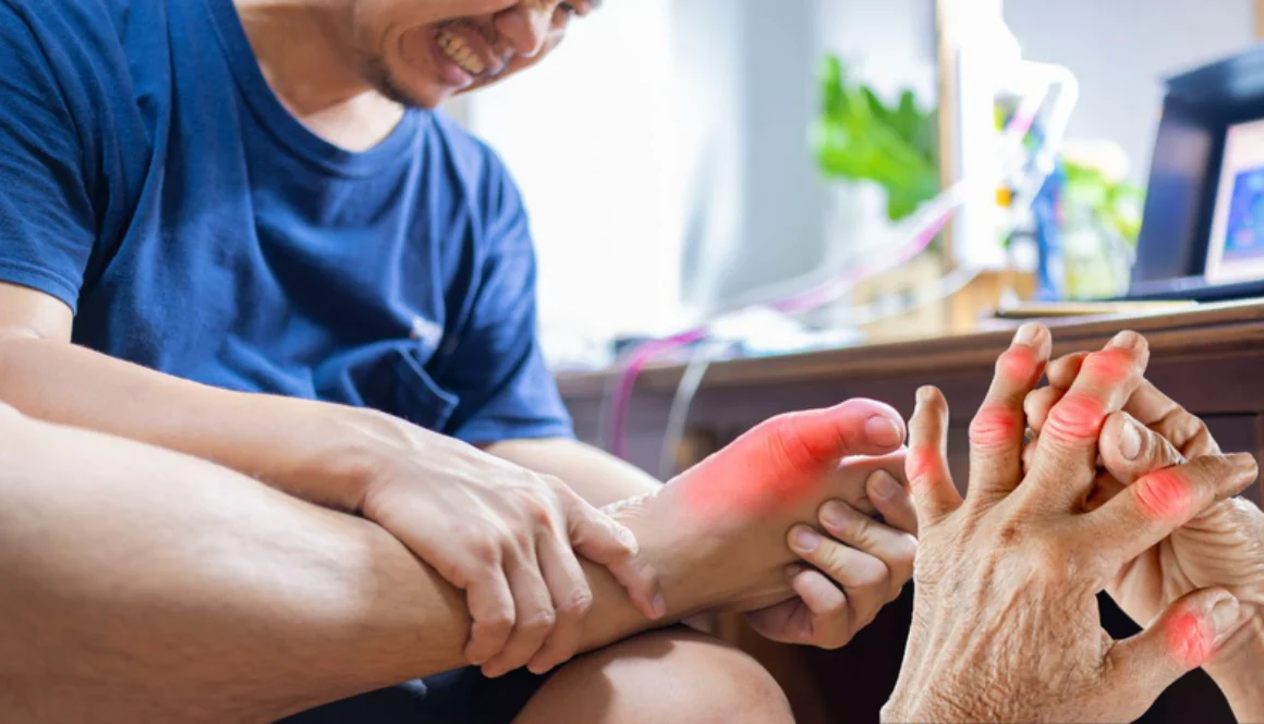 gout_cap_tinh_5_8beda04a99