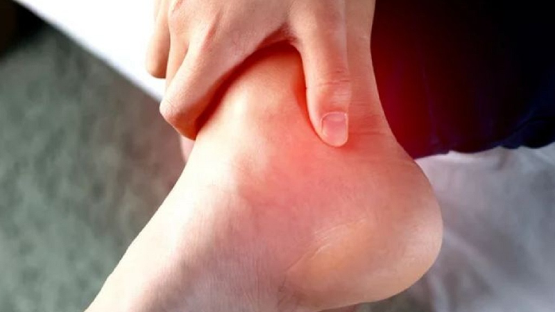 Đau Gout Có Nên Chườm Lạnh