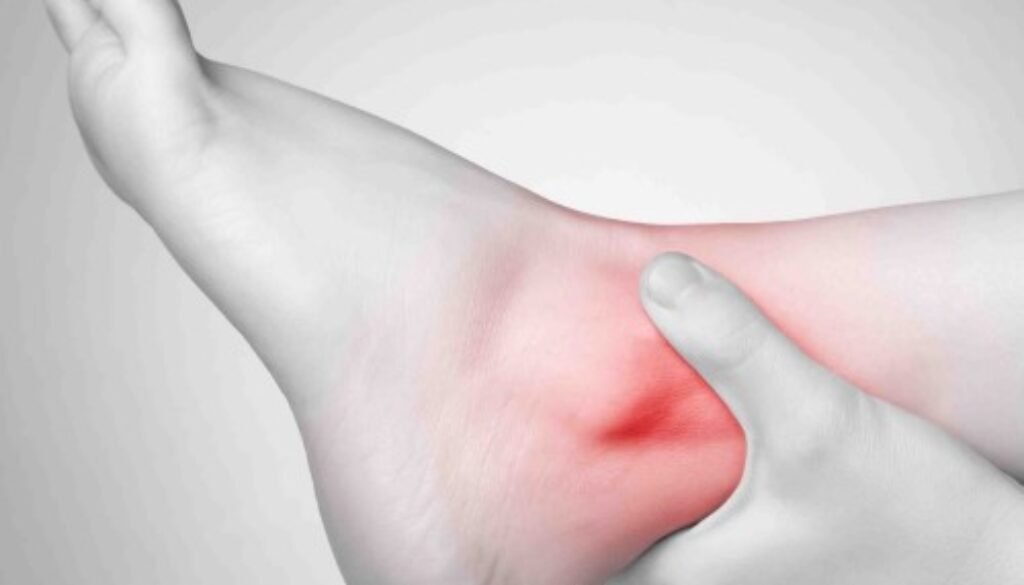 gout-dau-o-dau-1