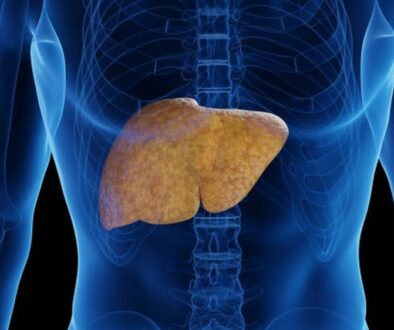 imagev3.vietnamplus.vn-w1000-uploaded-2024-hotnnz-2024_07_24-_benh-gan1-977