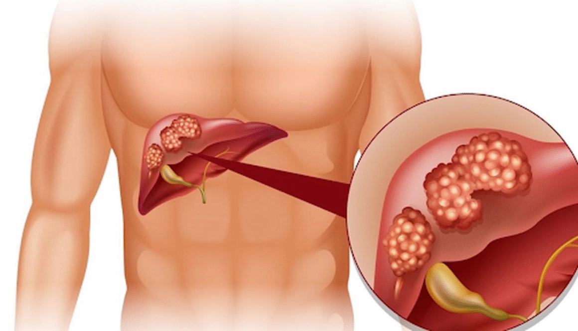 vien_uong_thai_doc_gan_dr_liver_jpanwell_60_vien_1_d039a1123d